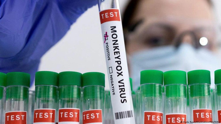 Theo hướng dẫn của Bộ Y tế, bệnh đậu mùa khỉ được chẩn đoán qua xét nghiệm sinh học phân tử (PCR hoặc tương đương) - Ảnh: AFP