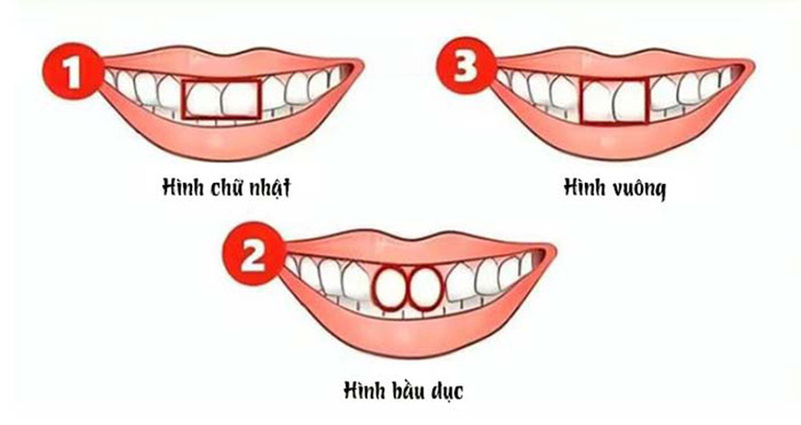 Hình dạng răng cửa nói gì về bạn? - Ảnh 1.