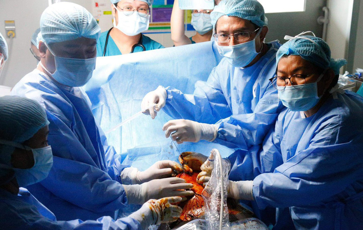 Ê kíp bác sĩ Bệnh viện Nhi đồng 1 và Bệnh viện Từ Dũ (TP.HCM) trong ca can thiệp bào thai đầu tiên - Ảnh: Bệnh viện cung cấp