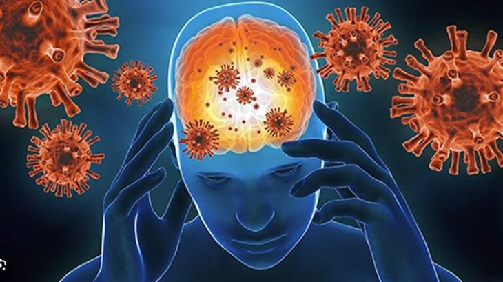 Miễn dịch cơ thể tấn công các tế bào khỏe mạnh ở não bộ - Ảnh minh họa 