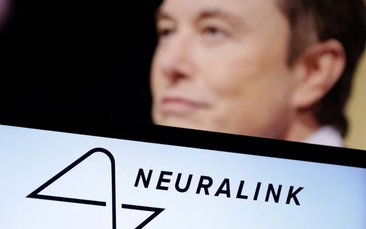 Công ty của Elon Musk lần đầu tiên cấy chip vào não người