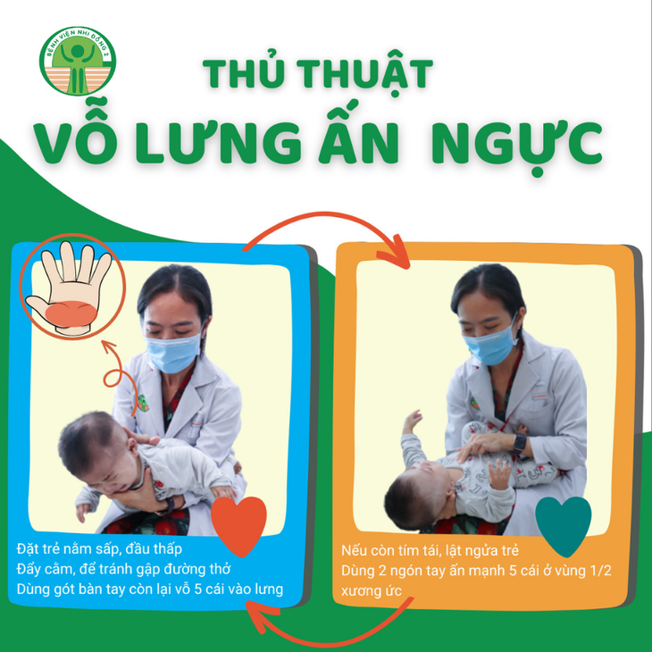 Bác sĩ Bệnh viện Nhi đồng 2 (TP.HCM) hướng dẫn xử lý tình huống trẻ dưới 2 tuổi mắc dị vật - Ảnh: Bệnh viện cung cấp