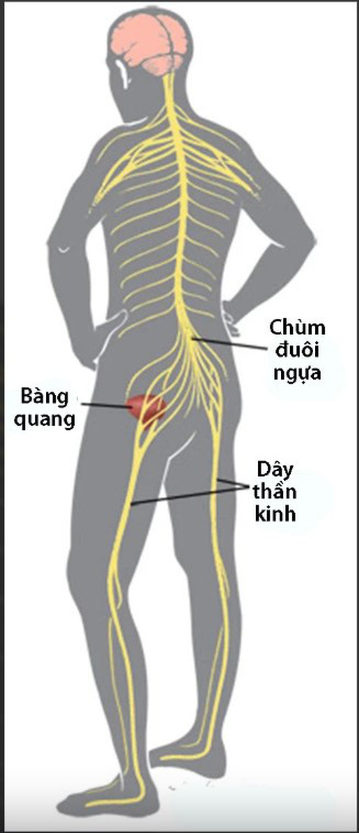 Đau lưng, đau cổ có thể là dấu hiệu bệnh lý cột sống nguy kịch - Ảnh 2.