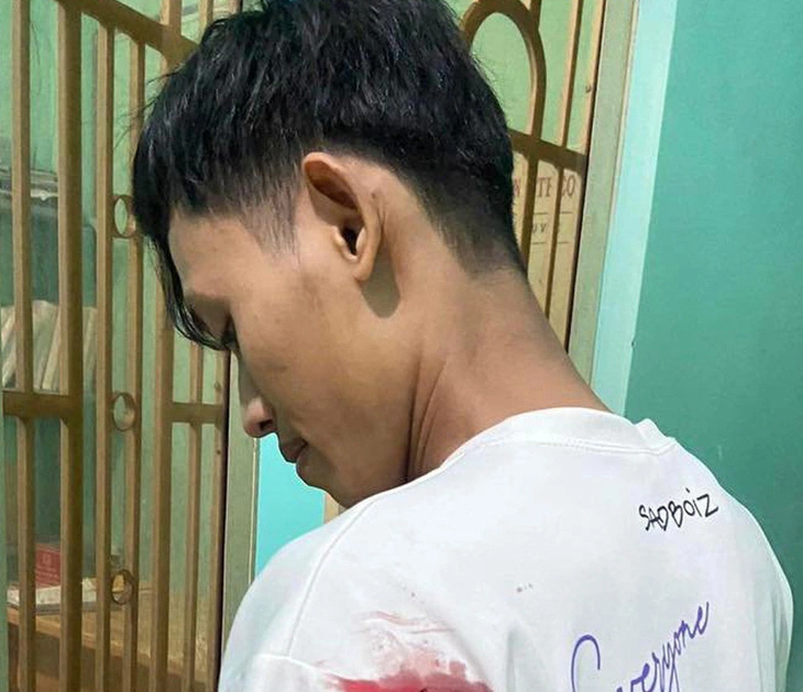 Anh Nguyễn Minh Hiến, bảo vệ dân phố phường Phước Bình, bị thương ở vai trái - Ảnh: CTV