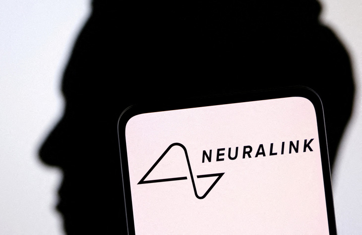 Bệnh nhân bị liệt được cấy chip đầu tiên của Neuralink đã có thể chơi cờ trên máy tính bằng não bộ - Ảnh: REUTERS