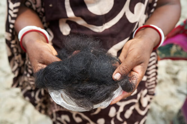 Bà Shyamoli Munda, một nông dân sống tại Satkhira, cầm trên tay nắm tóc rụng do tắm gội bằng nguồn nước không an toàn - Ảnh: WATERAID