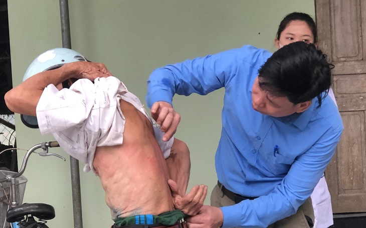 Hàng loạt người dân ở Thanh Hóa bị ngứa ngoài da kéo dài chưa rõ nguyên nhân