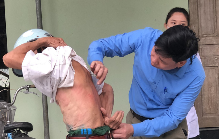 Cán bộ y tế kiểm tra vùng ngứa ngoài da cho một người dân ở xã Vĩnh Hòa, huyện Vĩnh Lộc - Ảnh: Trung tâm Kiểm soát bệnh tật tỉnh Thanh Hóa cung cấp