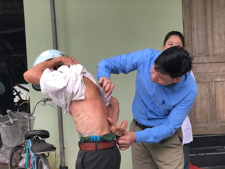 Cán bộ y tế kiểm tra bệnh ngứa ngoài da trên lưng một người dân thôn Quang Biểu, xã Vĩnh Hòa, huyện Vĩnh Lộc - Ảnh: Trung tâm Kiểm soát bệnh tật tỉnh Thanh Hóa cung cấp