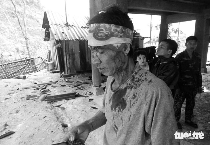 Ông Ốc Phò Thắng, ngụ xã Bảo Thắng, huyện Kỳ Sơn, Nghệ An, bị thương do ngói rơi trúng đầu sau mưa đá, lốc xoáy - Ảnh: TÂM PHẠM