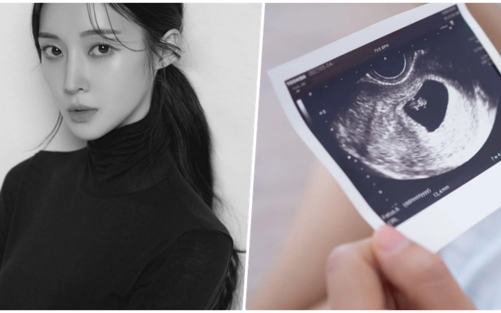 Cựu thành viên T-ara - Areum bất ngờ thông báo mang thai