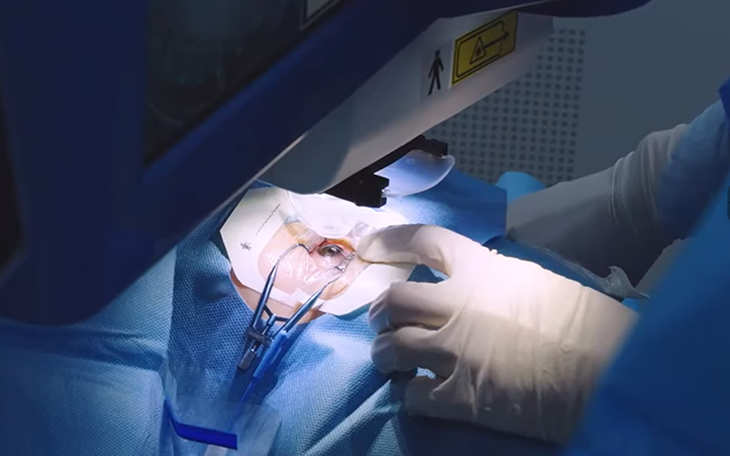 SmartSight - công nghệ phẫu thuật tật khúc xạ hiện đại với nhiều ưu điểm vượt trội