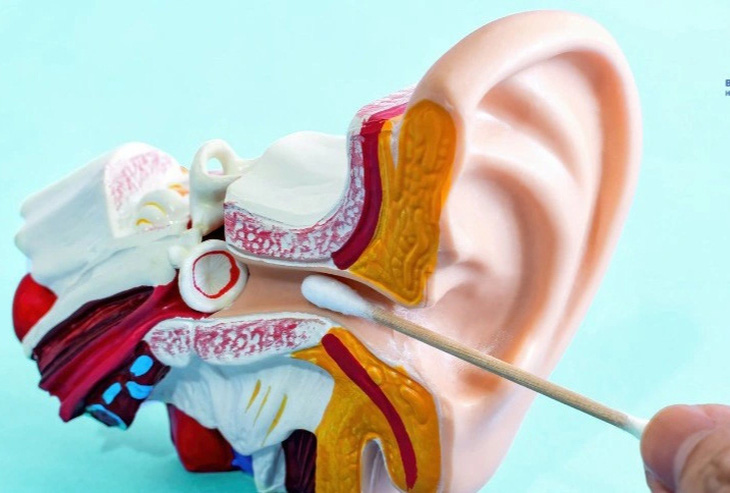 Dùng tăm bông ngoáy tai có thể rất nguy hiểm - Ảnh minh họa: BVCC
