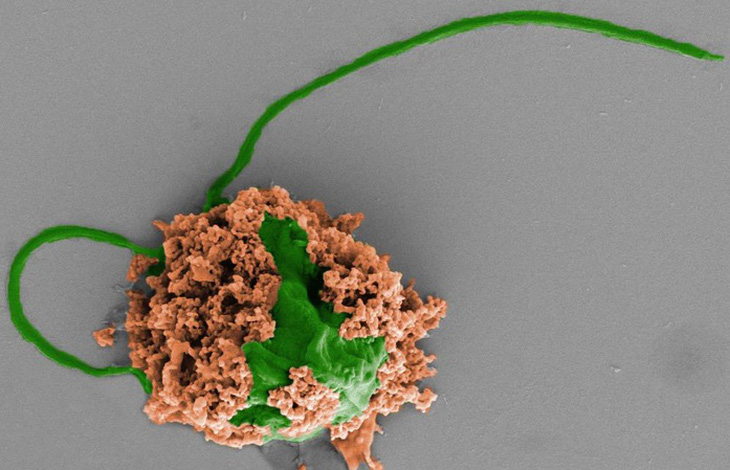 Robot tảo siêu nhỏ giúp điều trị ung thư phổi - Ảnh: Fangyu Zhang and Zhengxing Li