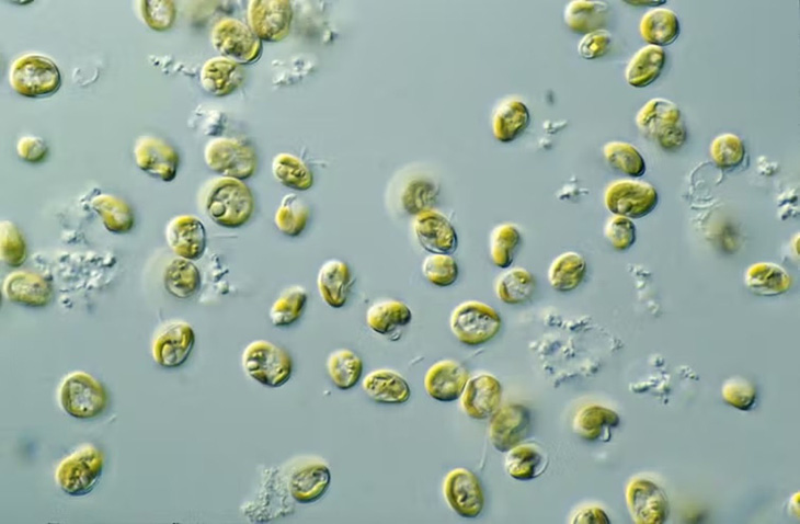 Vi tảo lục có thể bơi trong cơ thể con người - Ảnh: CSIRO