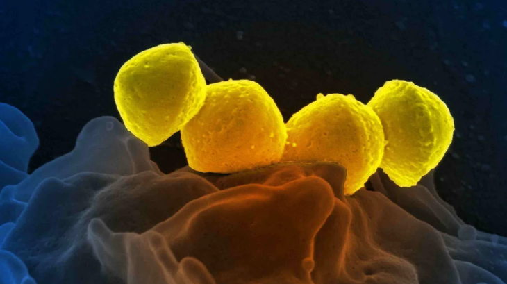 Ảnh vi khuẩn Streptococcus nhóm A (Streptococcus pyogenes) dưới kính hiển vi điện tử - Ảnh: Getty