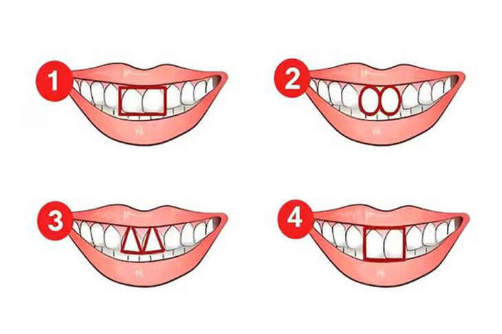 Quiz: Khám phá tính cách tiềm ẩn qua hình dạng răng cửa của bạn- Ảnh 1.