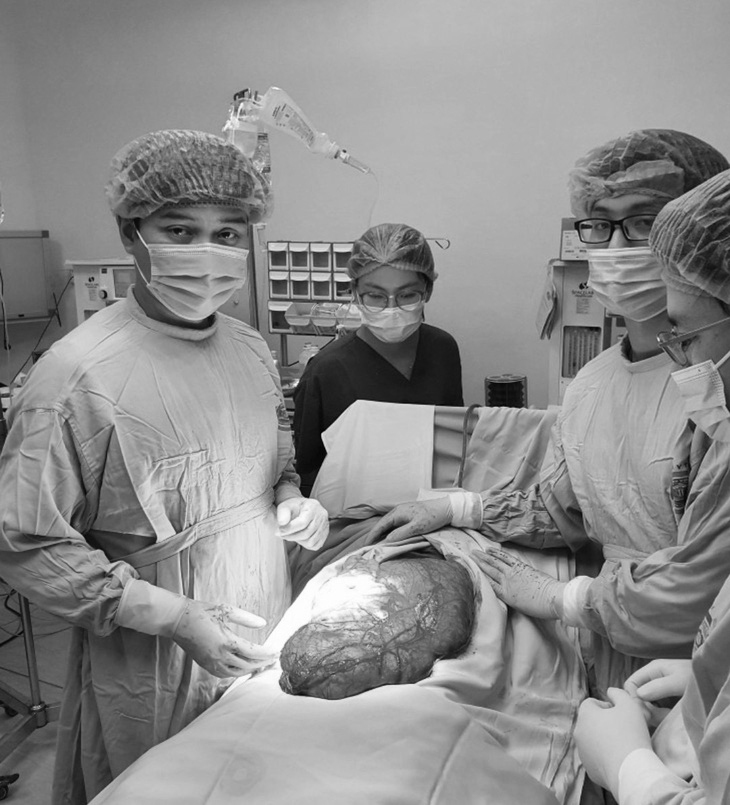 Các bác sĩ phẫu thuật thành công cắt bỏ khối u nặng 8kg cho nam thanh niên - Ảnh: Bệnh viện cung cấp