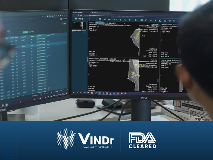 VinDr trở thành sản phẩm AI cho chẩn đoán X-quang tuyến vú đầu tiên và duy nhất tại Việt Nam được FDA công nhận. Ảnh: Đ.H