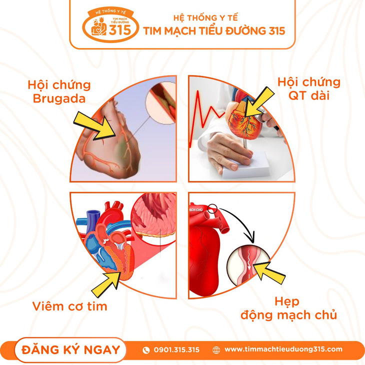 Những dấu hiệu sức khỏe tiềm ẩn nguy cơ đột tử khi chơi thể thao- Ảnh 3.