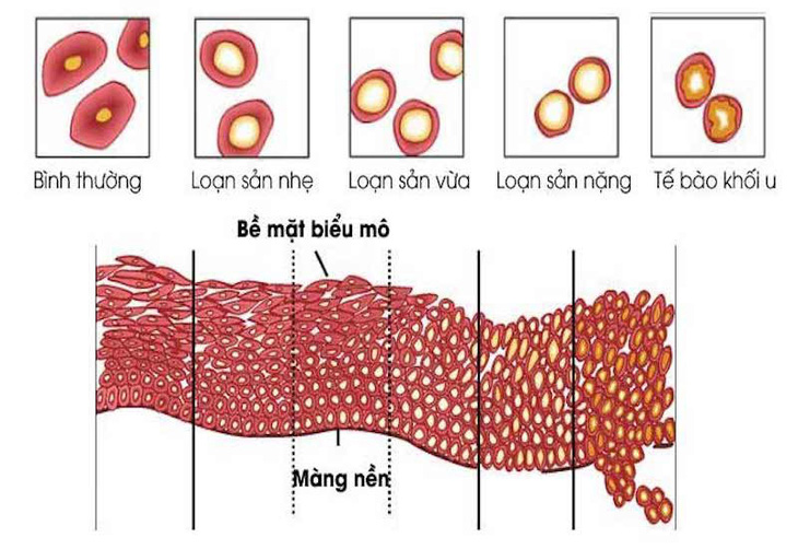 20221012loan-san-co-tu-cung-2-1-17229908119751067184617.jpg