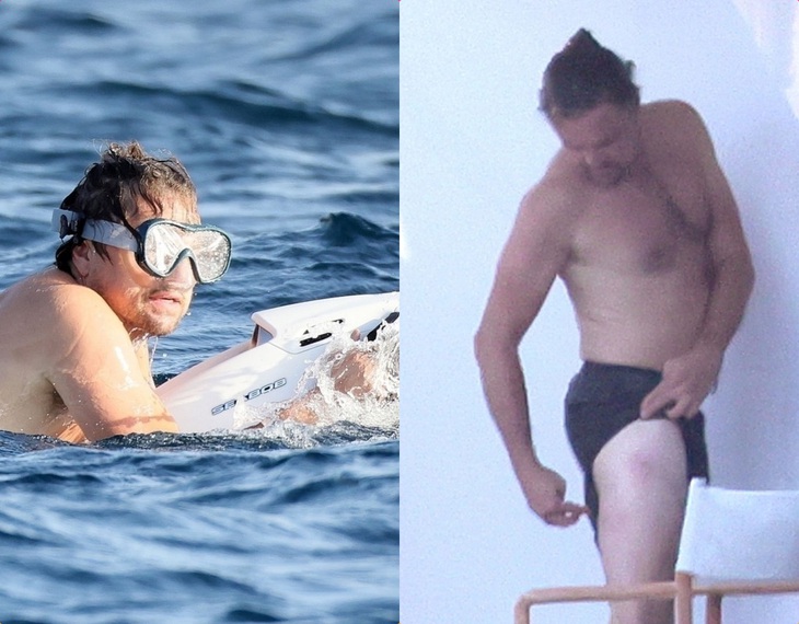 Leonardo DiCaprio bị sứa đốt khi đang hẹn hò- Ảnh 1.