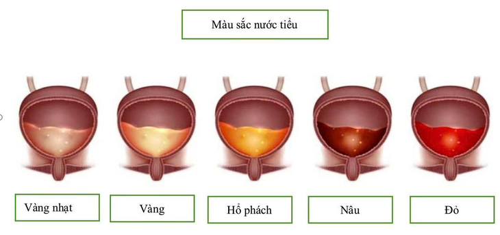 mau-sac-nuoc-tieu-1727274276617859594182.jpg