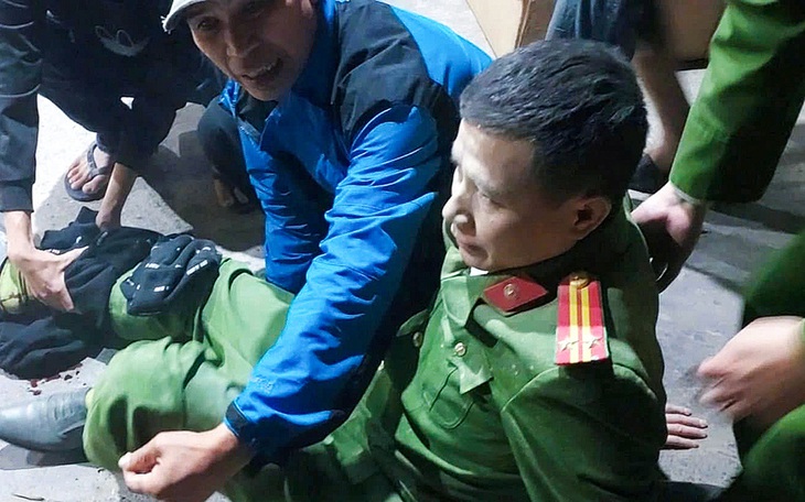 Phó trưởng công an huyện bị thương khi tham gia chữa cháy đã bình phục - Ảnh 1. Phó trưởng Công an huyện bị thương khi chữa cháy - Ảnh 1.