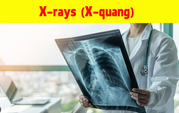 Phát minh gì giúp con người nhìn xuyên qua bức tường? - Ảnh 6.