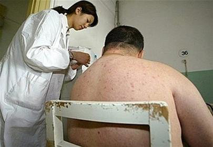 Trung Quốc: 1/4 dân số bị thừa cân hay béo phì