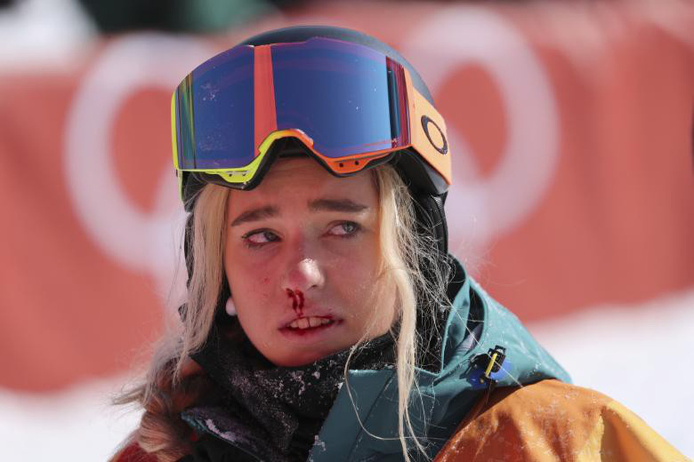 Vũ điệu mùa đông ở Pyeongchang - Ảnh 16. Vũ điệu mùa đông ở Pyeongchang - Ảnh 16.