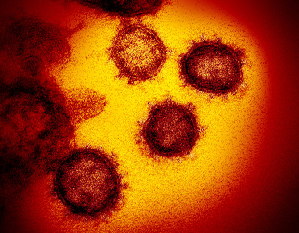 Virus corona chủng mới trông ra sao dưới kính hiển vi? - Ảnh 4.