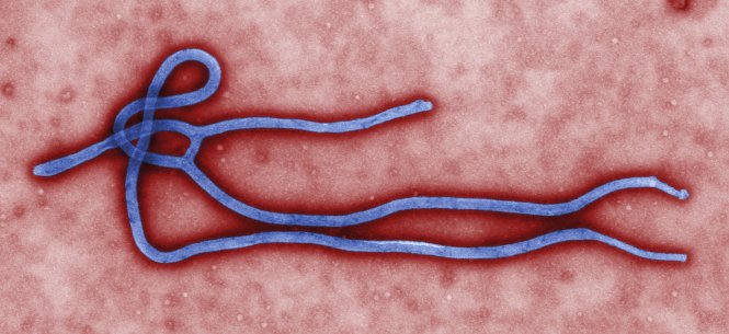 Một trong những hình thái siêu cấu trúc của virút Ebola - Ảnh: Reuters