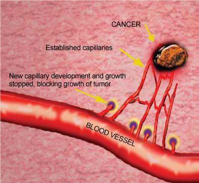 Ngăn nguồn cung cấp cho khối ung thư