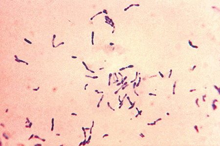 Dưới ống kính chụp ảnh quang học, vi khuẩn bạch hầu Corynebacterium diphtheriae gram dương được nhuộm màu xanh methylene. Ảnh: CDC Mỹ