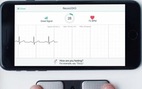 Theo dõi nhịp tim bằng smartphone có thể cứu sống bạn kịp thời