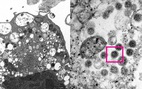 Công bố hình ảnh biến thể Omicron dưới kính hiển vi điện tử