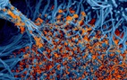 Các biến thể virus SARS-CoV-2 dùng 'chiêu' nào để lây nhiễm?