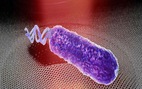 Phát hiện mới: Vi khuẩn phát ra âm thanh, chỉ tắt tiếng khi gặp kháng sinh