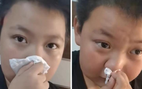 Bé trai khóc hết nước mắt vì bị dị ứng với 'mùi bài tập về nhà'