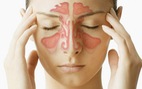 ​Điều trị dứt điểm viêm mũi họng để phòng bệnh viêm xoang