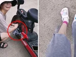 Cô gái bị bánh xe đạp điện xé rách quần