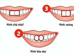 Hình dạng răng cửa nói gì về bạn?