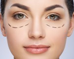 Cắt mí mắt, đừng để xấu vì thiếu hiểu biết