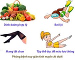 Phòng bệnh suy giãn tĩnh mạch chi dưới