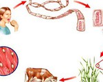 Phát hiện ổ bệnh 108 người nhiễm sán dây lợn tại Bình Phước