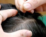 Tóc bạc mẹ tôi, từng sợi nhớ, sợi thương