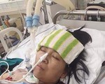 Tử vong vì tai biến y khoa sau chụp mạch não