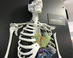Các bệnh viện đã bắt đầu tạo ra bộ phận cơ thể bằng công nghệ in 3D