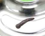 Đỉa trâu gần 10cm sống trong cổ họng bệnh nhân nhiều ngày